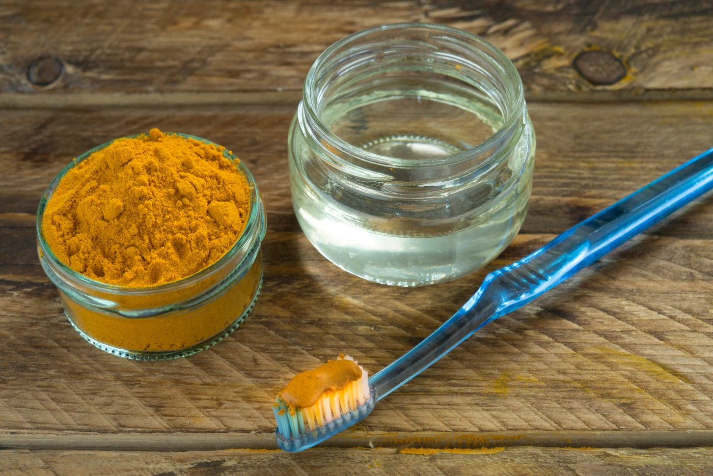6 Things Your Woodland Hills Dentist Wants You to Know Before You Whiten Your Teeth at Home