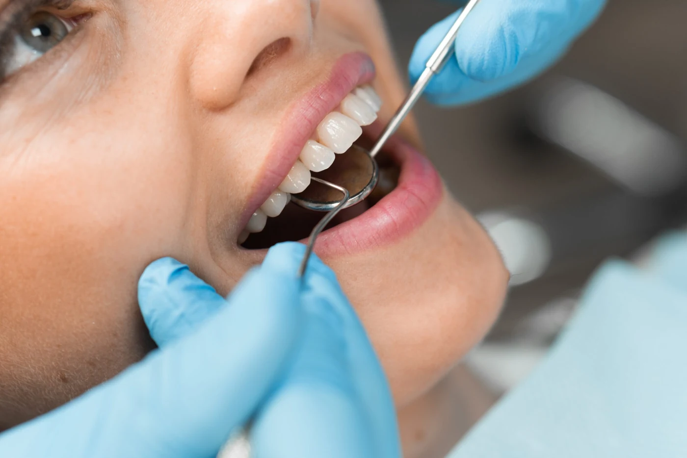 Dental Implant Procedure: Everything You Need to Know and What Comes Next