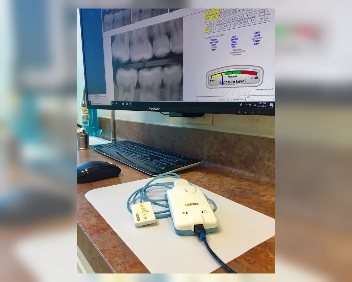Digital dental X-ray monitor and scanning equipment at Smiles by Eddie
