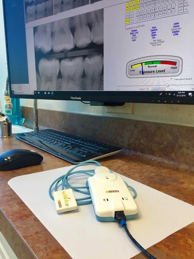 Digital X-ray monitor and scanner equipment in a treatment room